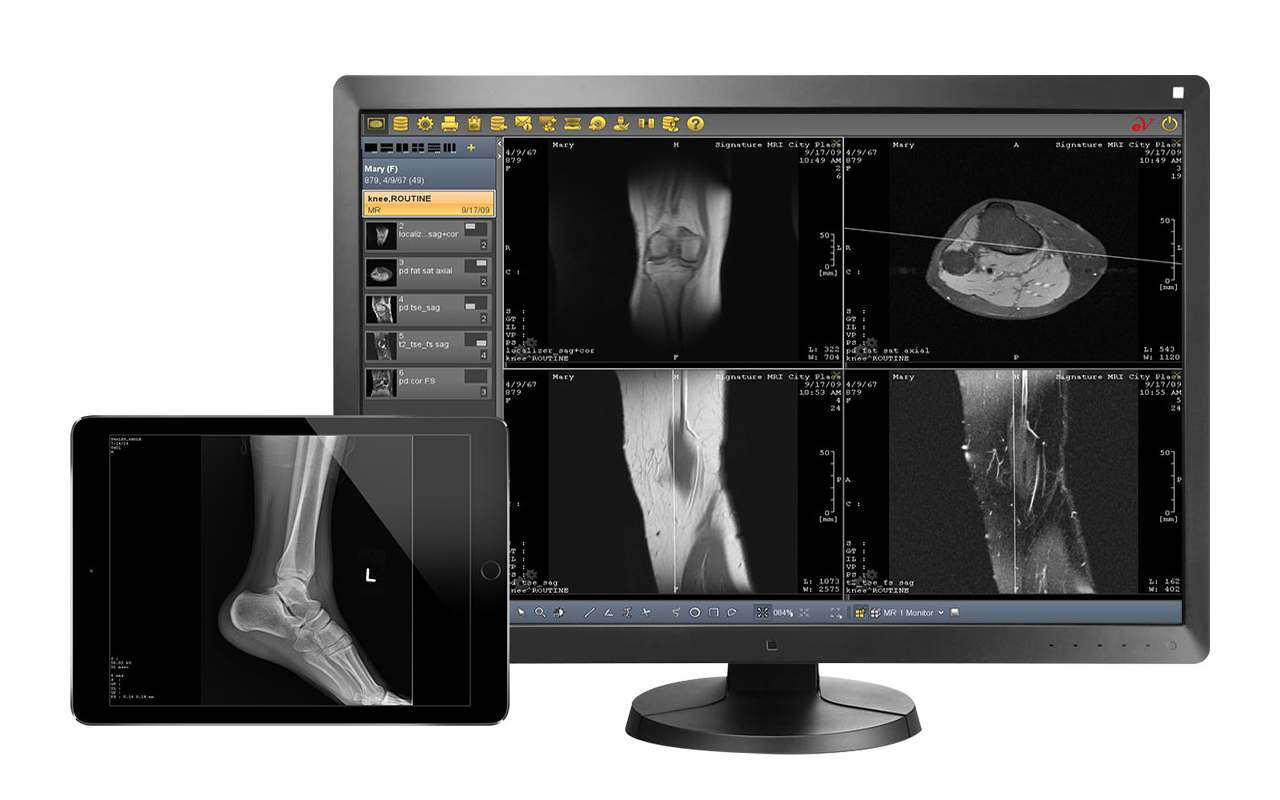 PACS medical imaging